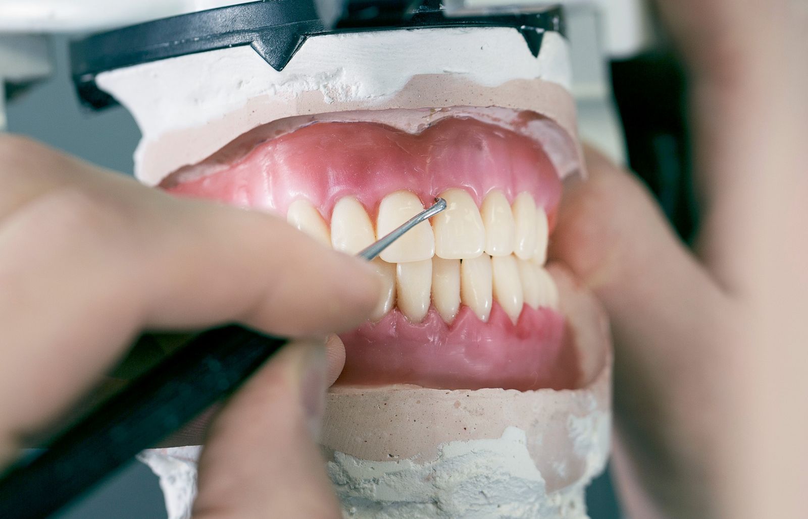 Kunstgebitten (ook wel een prothese genoemd):